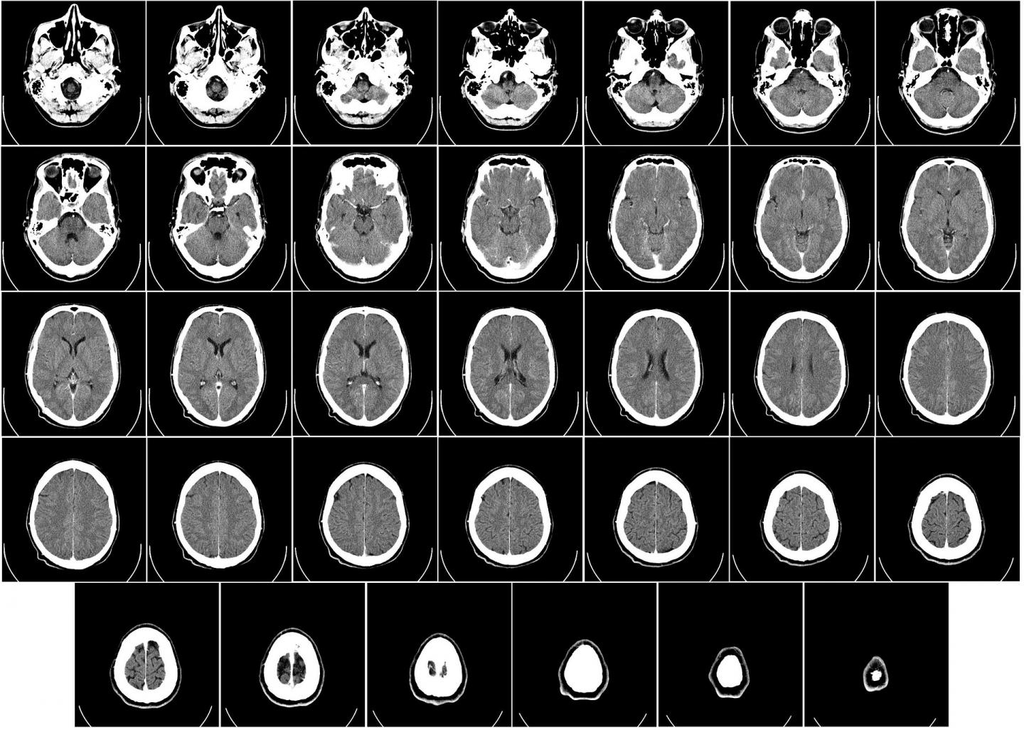A dual-modality approach to motion-corrected tomography for medical applications